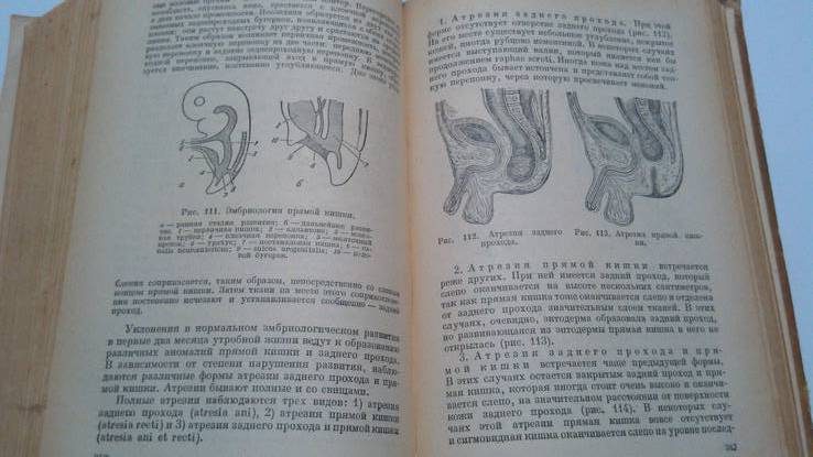 Хирургия детского возраста медгиз 49 год, фото №8