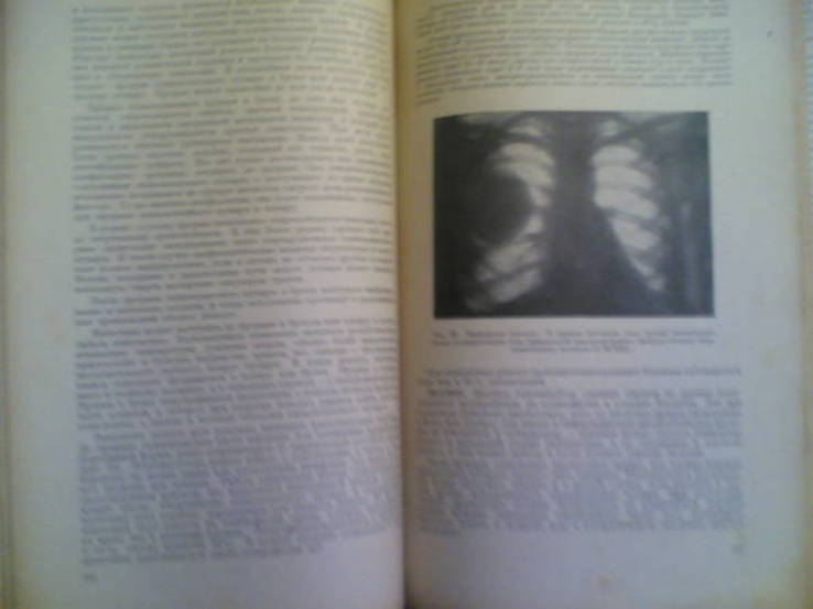 Медицинский учебник 1947 года, 792 стр. 17 х 26,5 см., фото №5