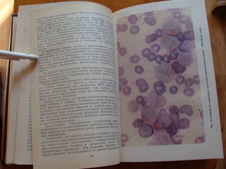 Болезни системы крови., фото №8