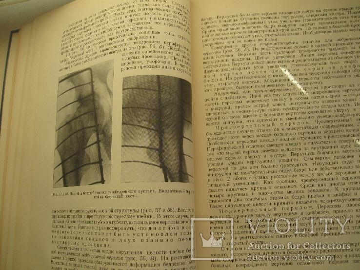 Неотложная рентгенодиагностика. Руководство для врачей.1957 год., фото №7