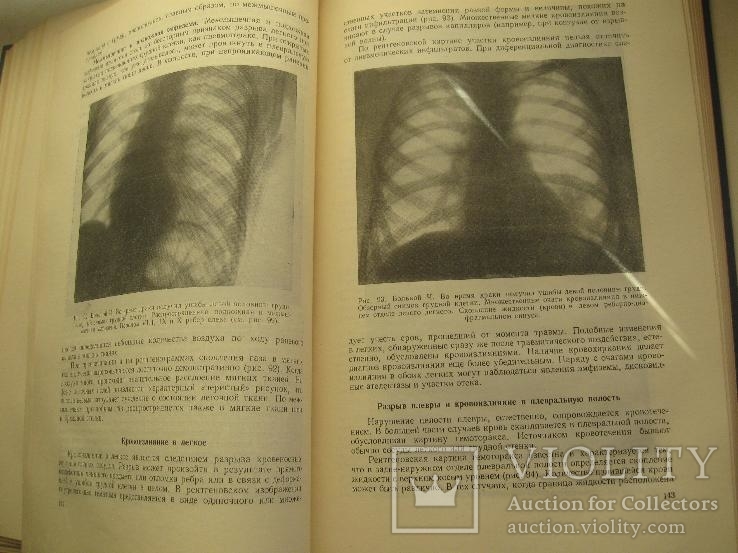 Неотложная рентгенодиагностика. Руководство для врачей.1957 год., фото №8