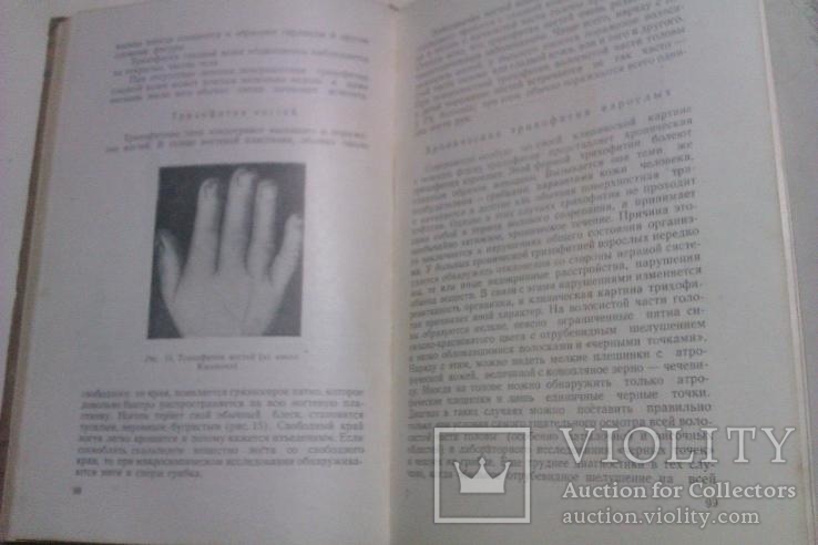 Фандеев Л. И. Кожные и венерические болезни. М. Медгиз 1954г., фото №6