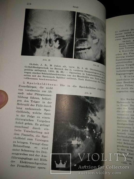 1944 год Военная медицина два тома одним лотом, фото №16