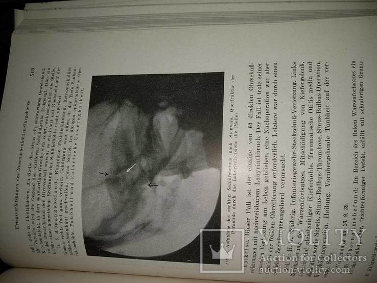 1944 год Военная медицина два тома одним лотом, фото №20