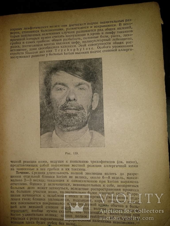 1938 год Учебник венерических и кожных болезней, фото №25