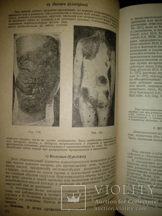 1938 год Учебник венерических и кожных болезней, фото №30