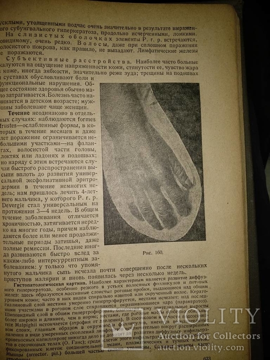 1938 год Учебник венерических и кожных болезней, фото №32