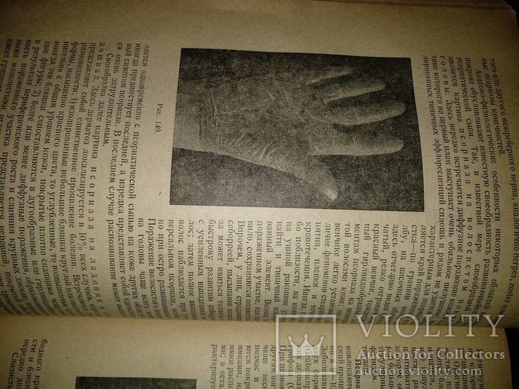 1938 год Учебник венерических и кожных болезней, фото №34