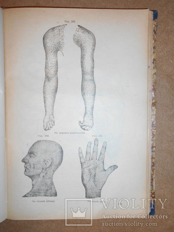 Медицина для Медиков и Юристов 1930 год Харьков, фото №7