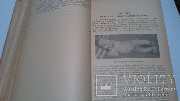 Медгиз 1949 год А.Тур Пропедевтика детских болезней, фото №5
