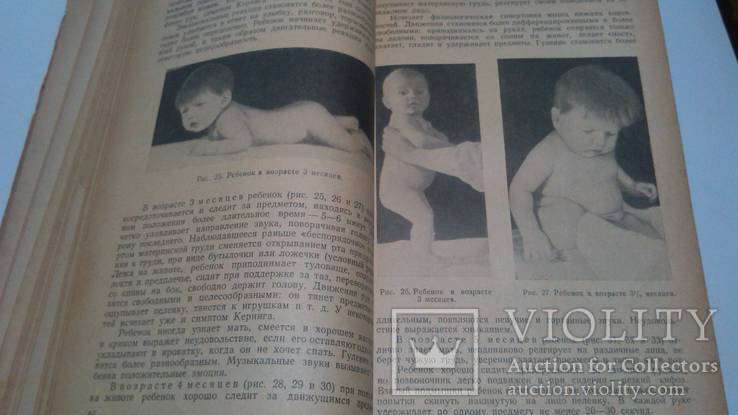 Медгиз 1949 год А.Тур Пропедевтика детских болезней, фото №6