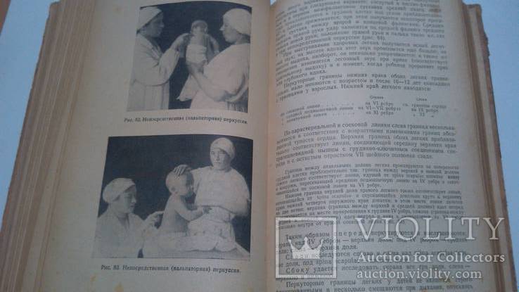 Медгиз 1949 год А.Тур Пропедевтика детских болезней, фото №10