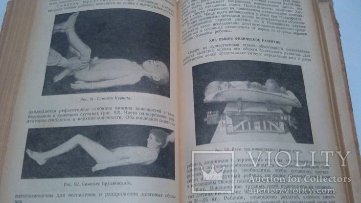 Медгиз 1949 год А.Тур Пропедевтика детских болезней, фото №11
