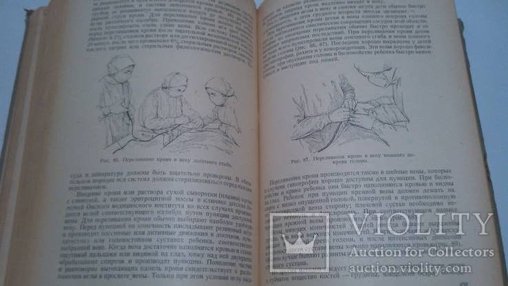 Медгиз 1951 год Переливание крови, фото №8