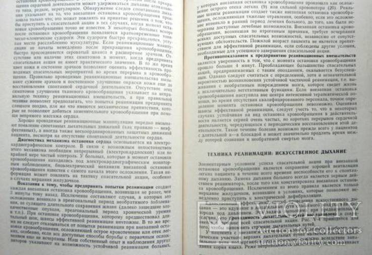 Интенсивная терапевтическая помощь.1973 г., фото №10