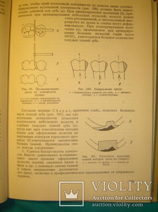 Микропротезирование.( Стоматология), фото №4