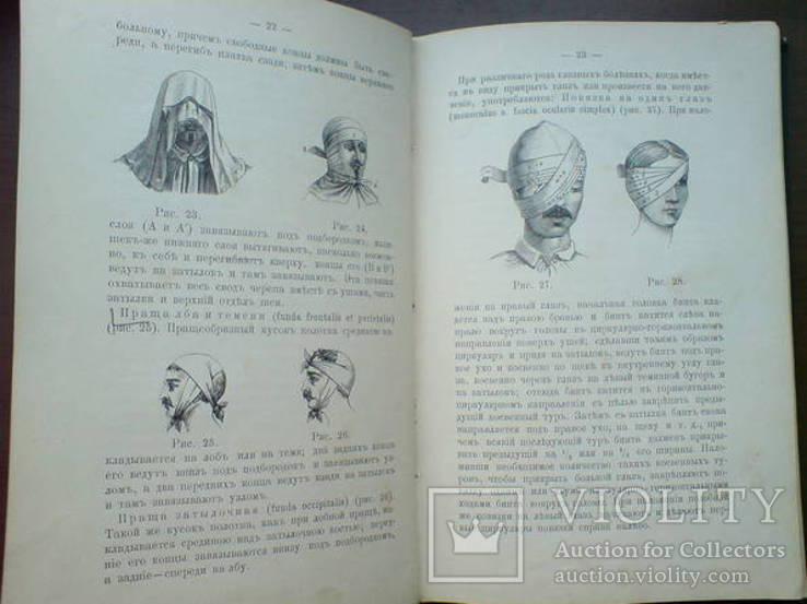 Десмургия. Руководство к изучению хирургических повязок 1890г. 164 рисунка, фото №8