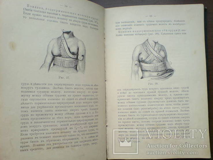 Десмургия. Руководство к изучению хирургических повязок 1890г. 164 рисунка, фото №9