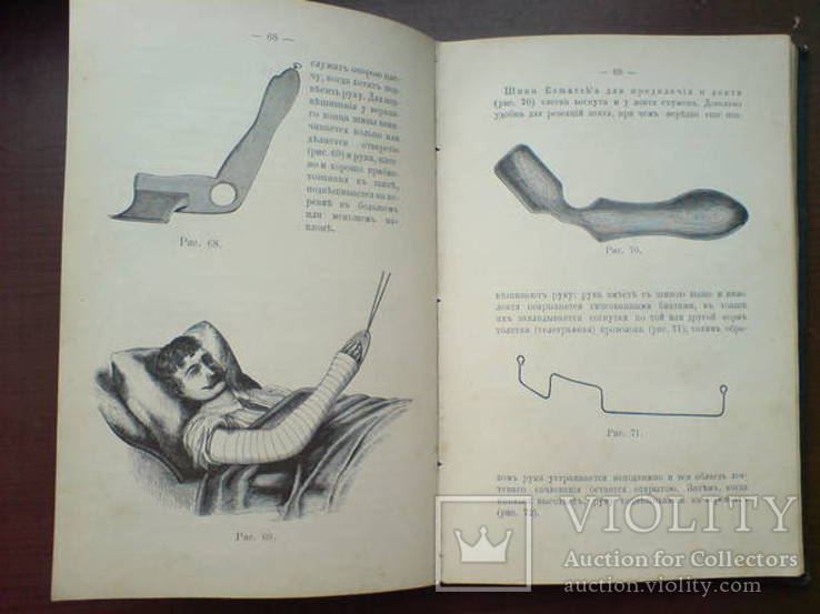 Десмургия. Руководство к изучению хирургических повязок 1890г. 164 рисунка, фото №10