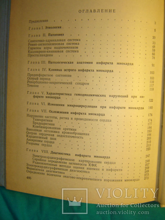 Инфаркт миокарда., фото №5