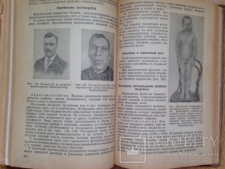 Учебник внутренних болезней. В.Х.Василенко. 1939. 432 с.,ил. 15 тыс.экз., фото №9