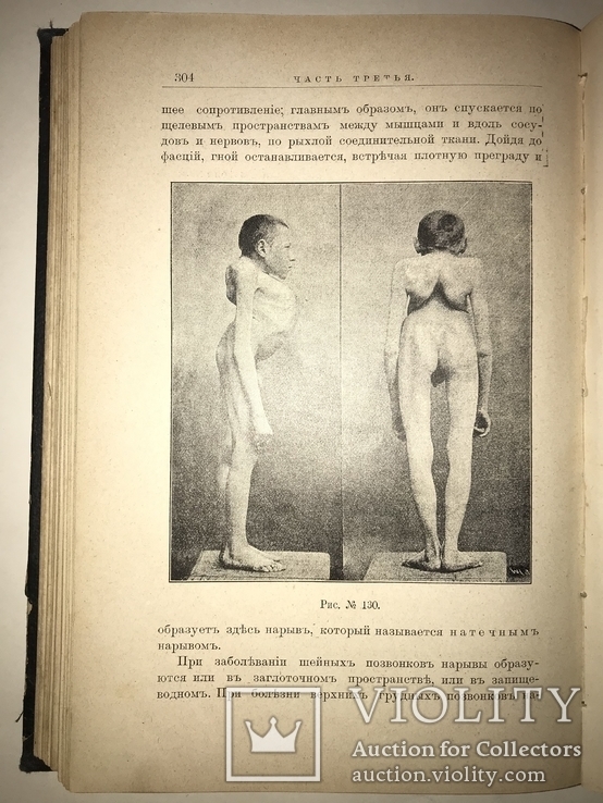 1898 Учебник Массажа для массажисток с 151 рисуноком, фото №5