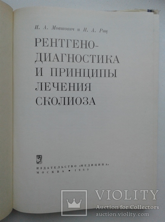 Рентгенодиагностика и принципы лечения сколиоза, фото №4