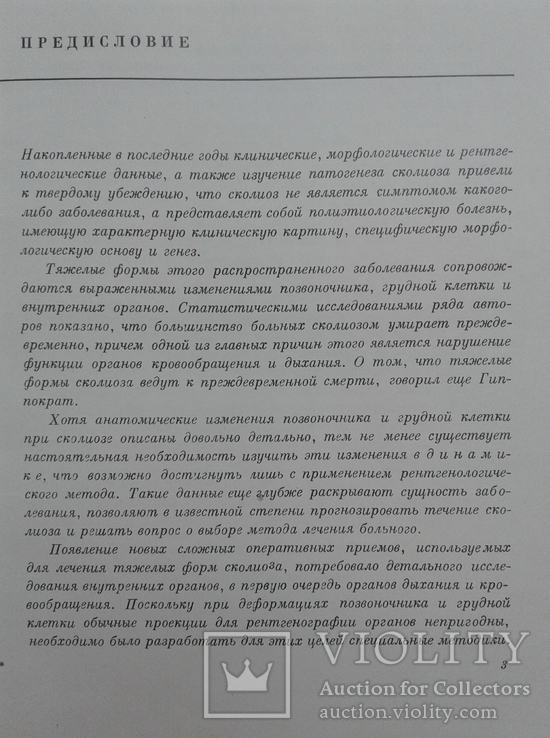 Рентгенодиагностика и принципы лечения сколиоза, фото №5