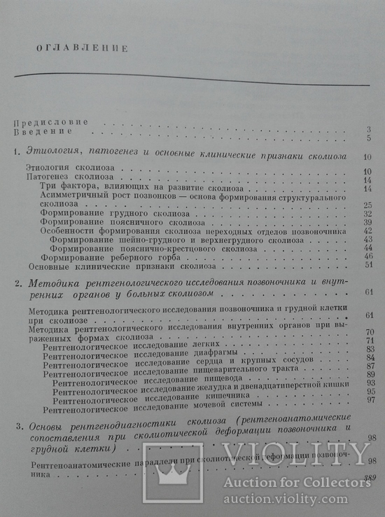 Рентгенодиагностика и принципы лечения сколиоза, фото №11