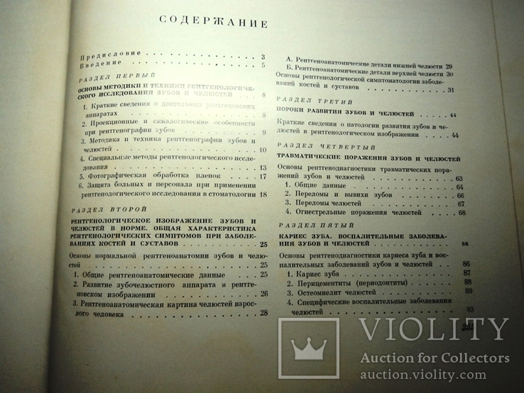 Атлас рентгенограмм зубов и челюстей в норме и патологии 1968г., фото №7