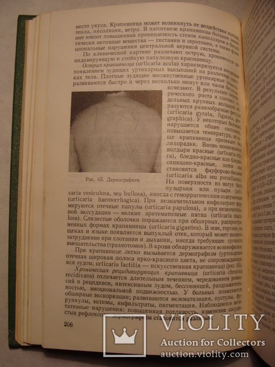 И.И. Потоцкий Н.А. Торсуев Кожные и венерические болезни, фото №12