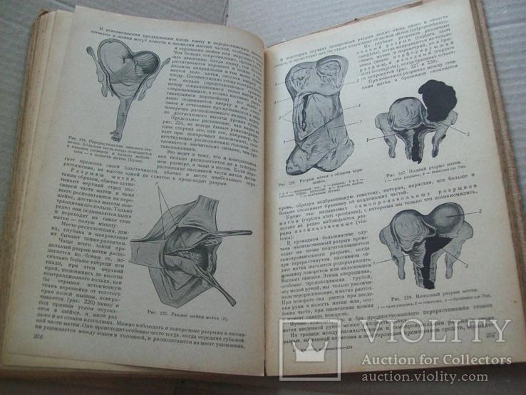 1946 г. Акушерство, фото №8