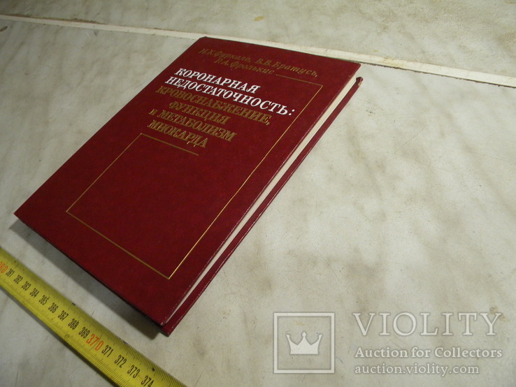 Коронарная недостаточность-  миокарда., фото №3