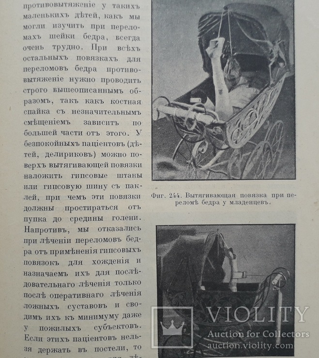 1911 г. Лечение переломов (для врачей) 273 рис., фото №8