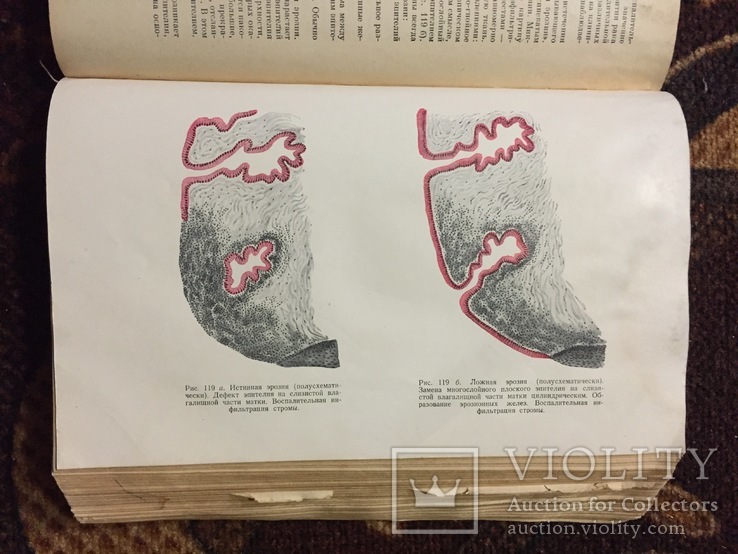 Оперативная гинекология 1952 год Брауде, фото №5