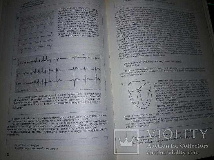 Книга "Нарушения ритма сердца" проф.Л.Томов,доц.И.Л.Томов 1976 год, фото №6