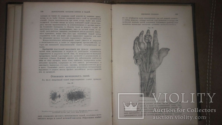 "Основы общей патологии" 1894 год,В.В.Подвысоцкий, фото №8