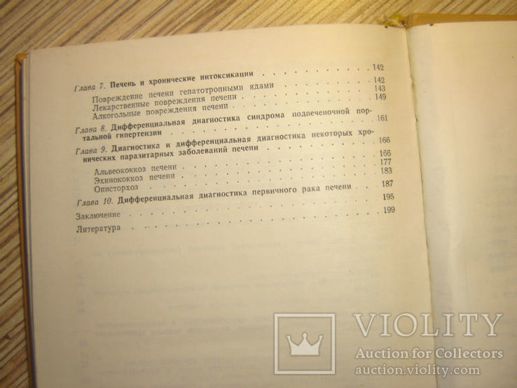 Дифференциальная диагностика хронических заболеваний печени., фото №8