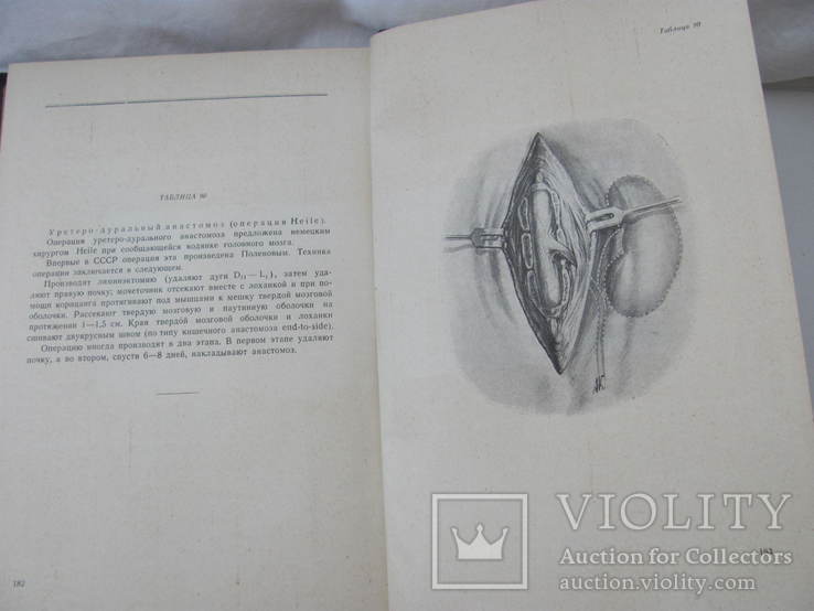 Поленов А.Л. Атлас операций на головном и спинном мозге 1945 г., фото №10