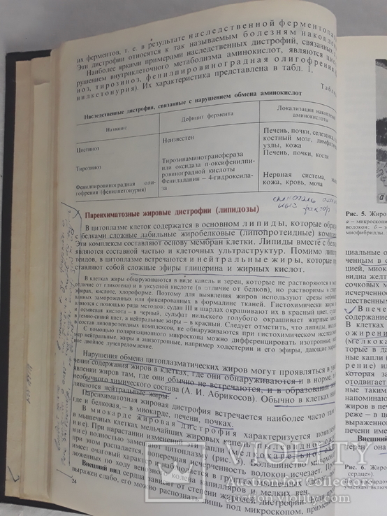 Патологическая анатомия А.И. Струков, В.В. Серов, фото №6