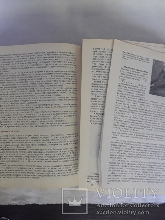 Патологическая анатомия А.И. Струков, В.В. Серов, фото №7