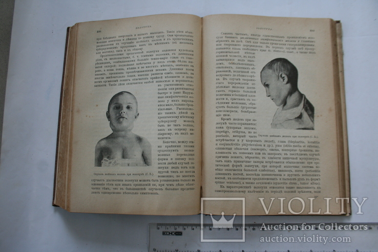 Семіотика и діагностика дитячих захворювань. 1912, фото №8