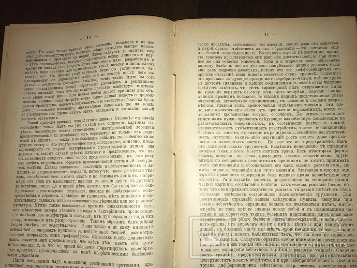 1906 Дерматология Чешуйчатый лишай и его лечение, фото №6