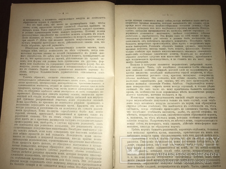 1906 Дерматология Распознавание и лечение Экземы, фото №4