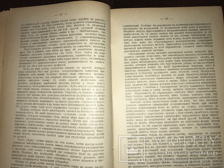 1906 Дерматология Распознавание и лечение Экземы, фото №6