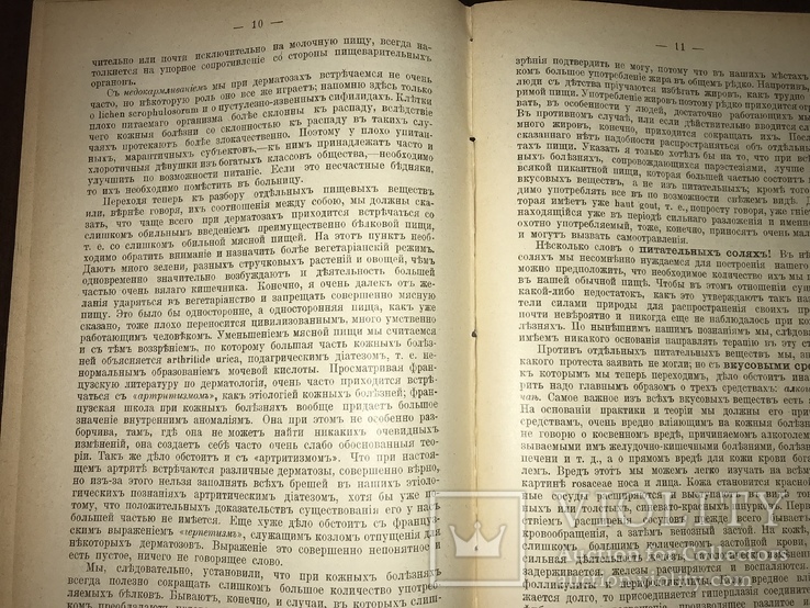 1906 Дерматология Внутреннее лечение Кожных заболеваний, фото №6