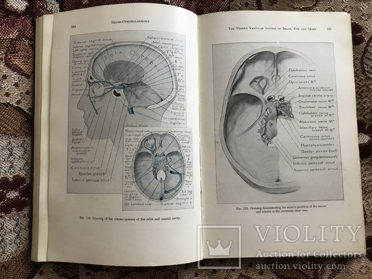 Neuro-ophthalmology, фото №6