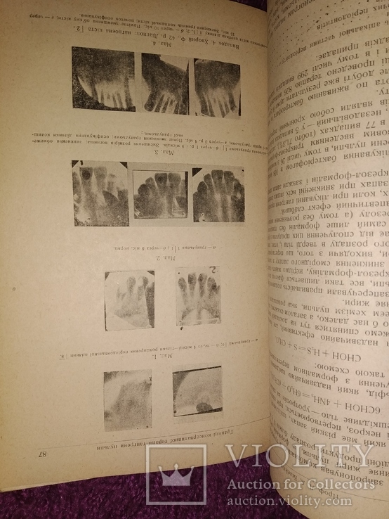 1939 Киев ский стоматологический институт. Працi. Тираж 400 экз, фото №6