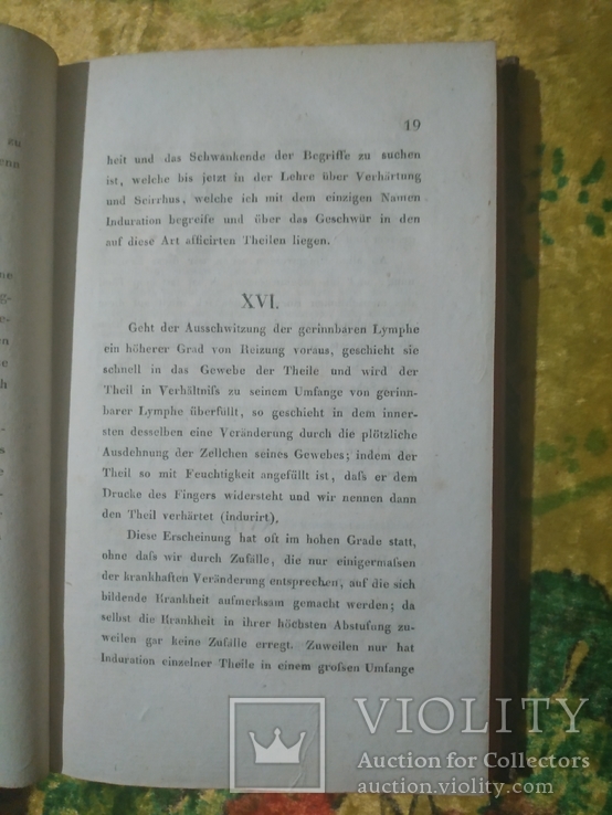 Об индурации и язвах в индурированных частях.  1815 год, фото №6