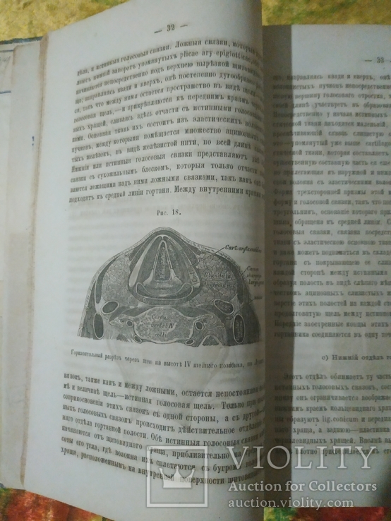 Руководство к общей и частной хирургии.  1877 год., фото №6